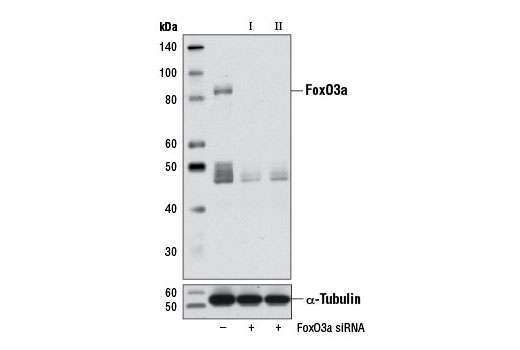  Image 1: SignalSilence® FoxO3a siRNA I (Mouse Specific)