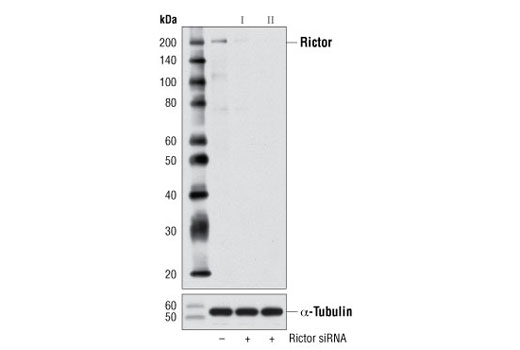  Image 1: SignalSilence® Rictor siRNA II