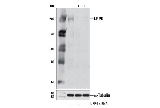  Image 1: SignalSilence® LRP6 siRNA II