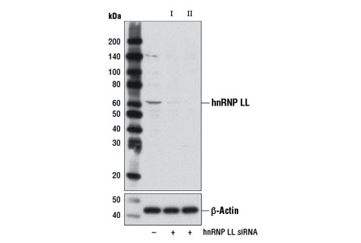  Image 1: SignalSilence® hnRNP LL siRNA II