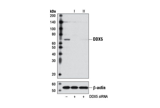  Image 1: SignalSilence® DDX5 siRNA I