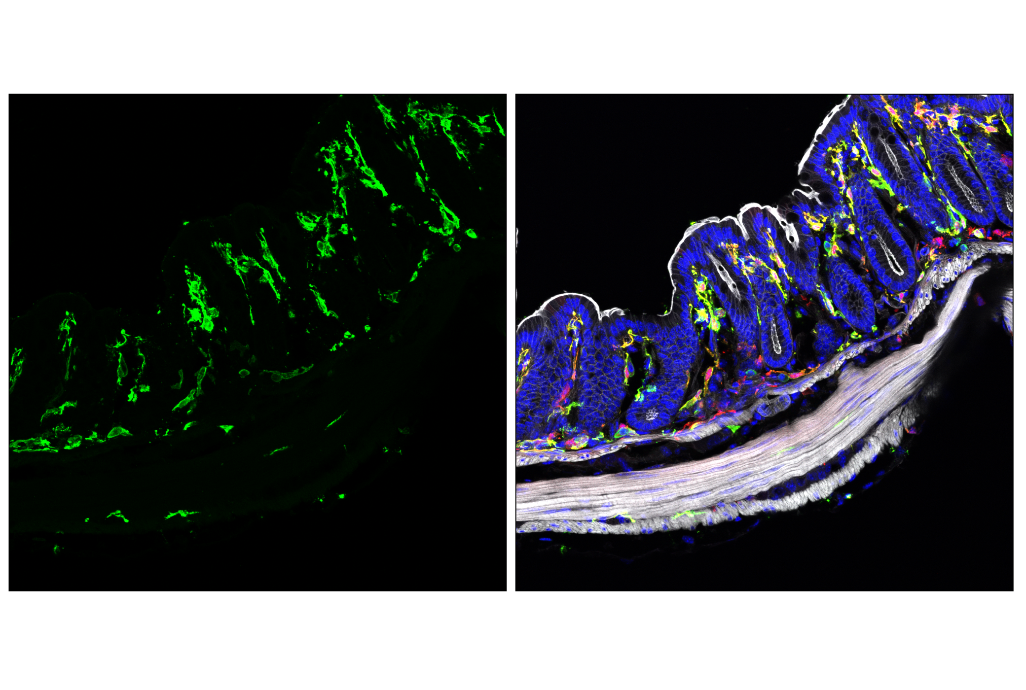 Immunofluorescence Image 4: MHC Class II (I-A/I-E) (M5/114.15.2) Rat mAb
