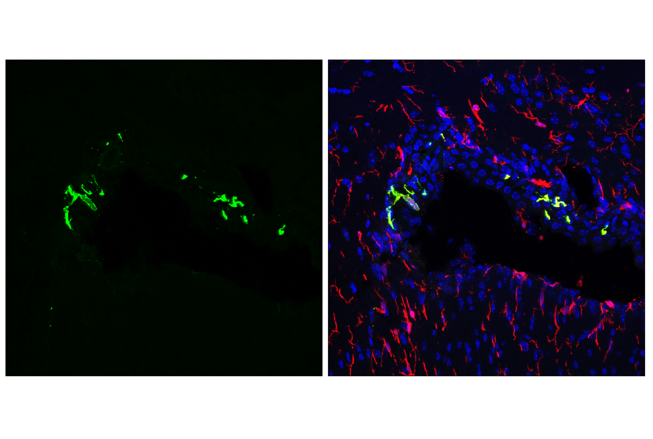 Immunofluorescence Image 1: MHC Class II (I-A/I-E) (M5/114.15.2) Rat mAb