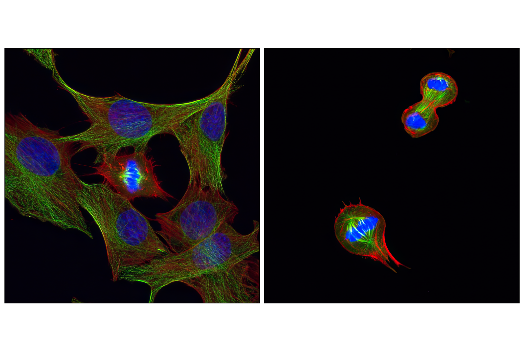Immunofluorescence Image 1: β-Tubulin (D3U1W) Mouse mAb