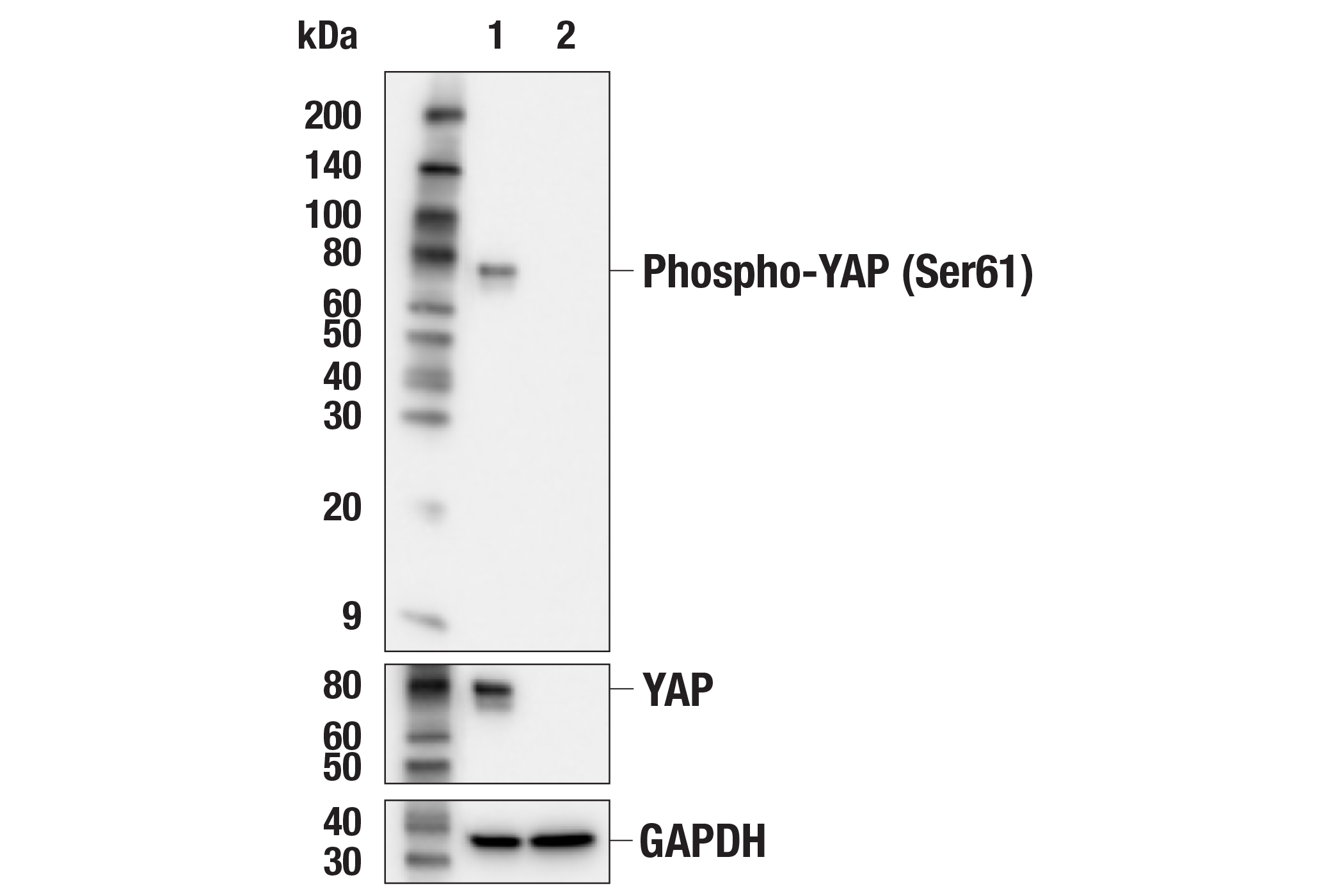 Western Blotting Image 1: Phospho-YAP (Ser61) (E4Q8S) Rabbit mAb