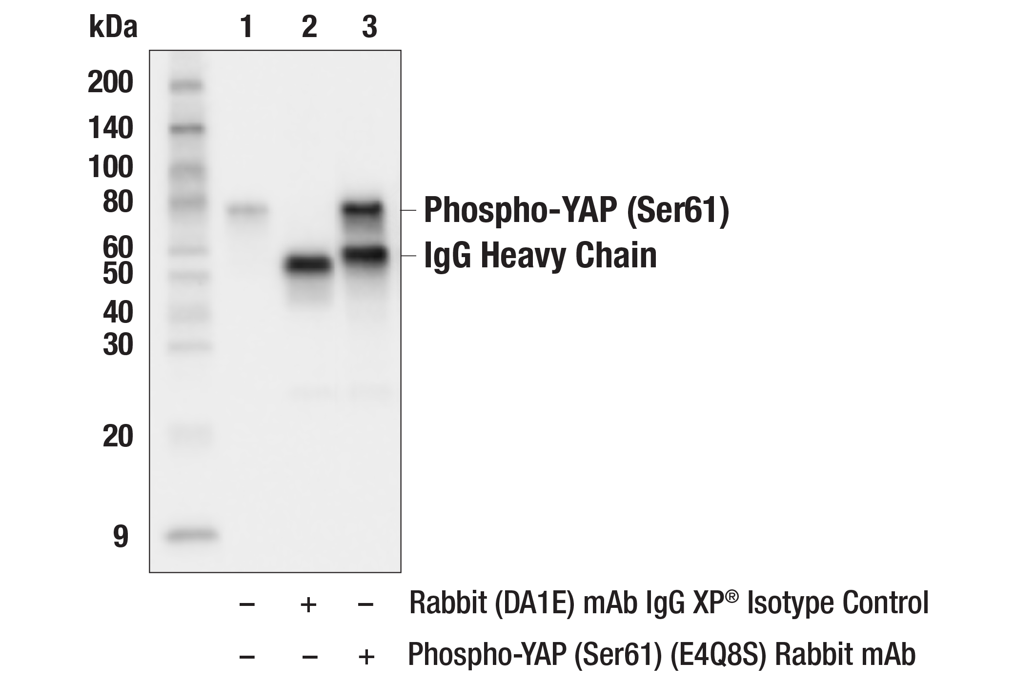 Immunoprecipitation Image 1: Phospho-YAP (Ser61) (E4Q8S) Rabbit mAb