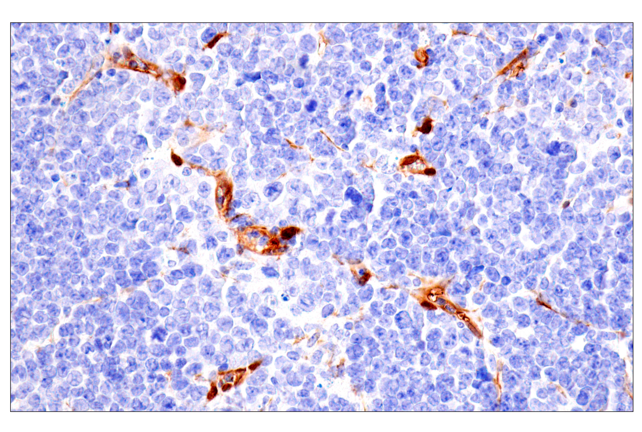 Immunohistochemistry Image 11: Phospho-YAP (Ser61) (E4Q8S) Rabbit mAb