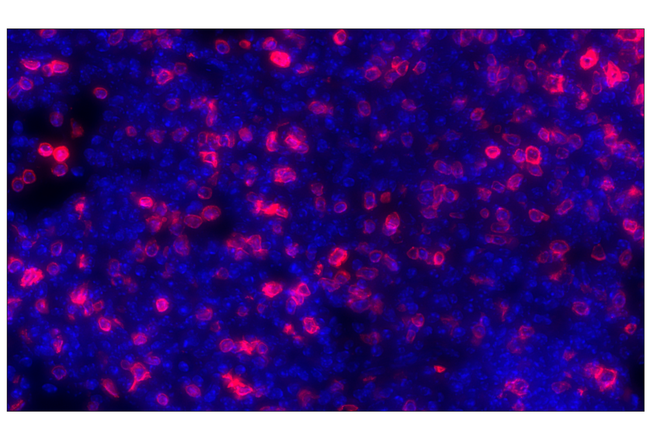 Immunohistochemistry Image 1: CD3ε (E4T1B) XP® Rabbit mAb (Alexa Fluor® 647 Conjugate)