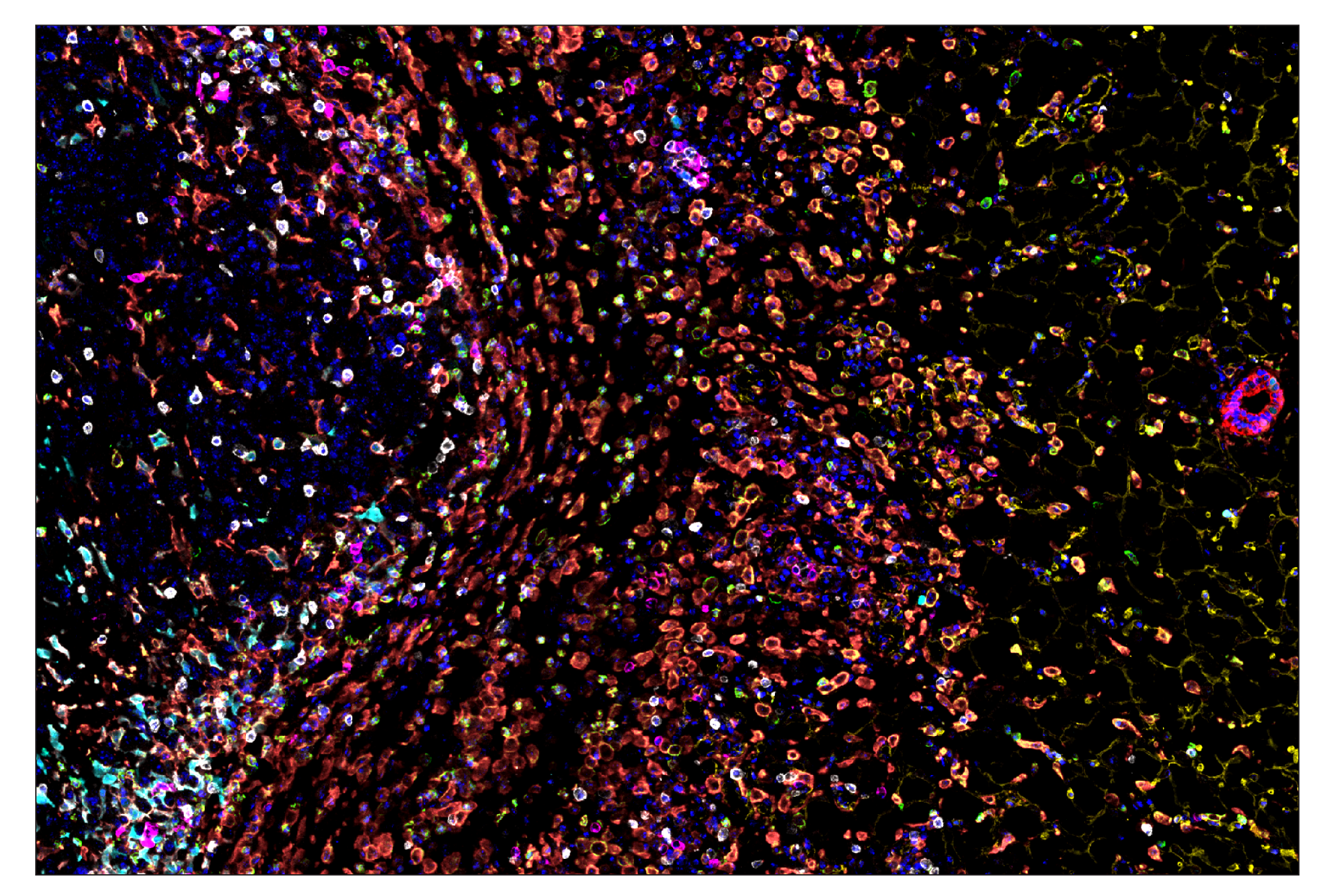 Immunohistochemistry Image 7: CD11b/ITGAM (E4K8C) & CO-0083-647 SignalStar™ Oligo-Antibody Pair