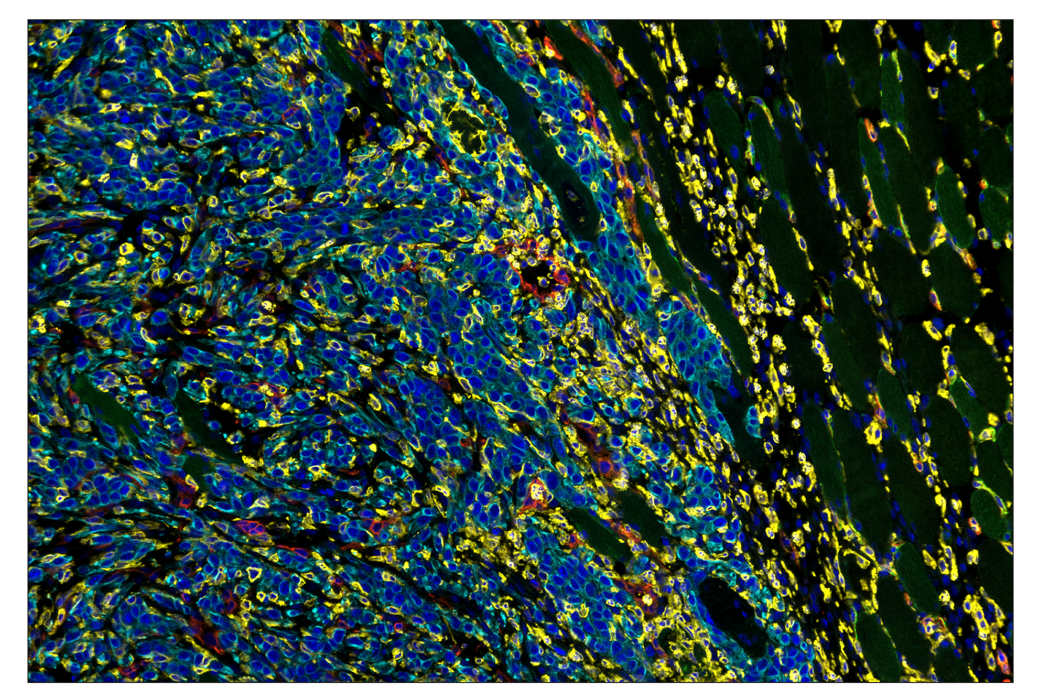 Immunohistochemistry Image 8: CD11b/ITGAM (E4K8C) & CO-0083-750 SignalStar™ Oligo-Antibody Pair