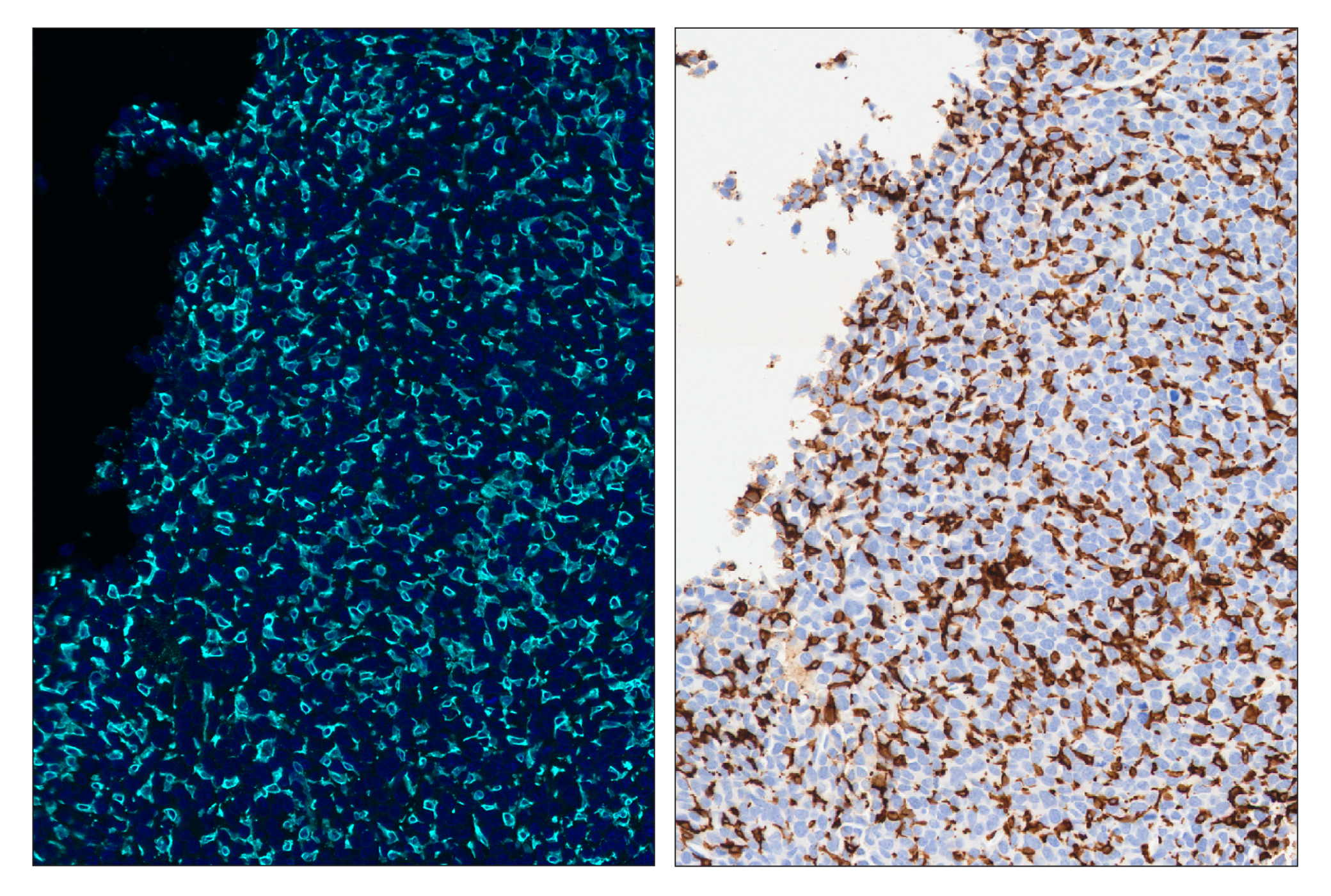 Immunohistochemistry Image 6: CD11b/ITGAM (E4K8C) & CO-0083-647 SignalStar™ Oligo-Antibody Pair