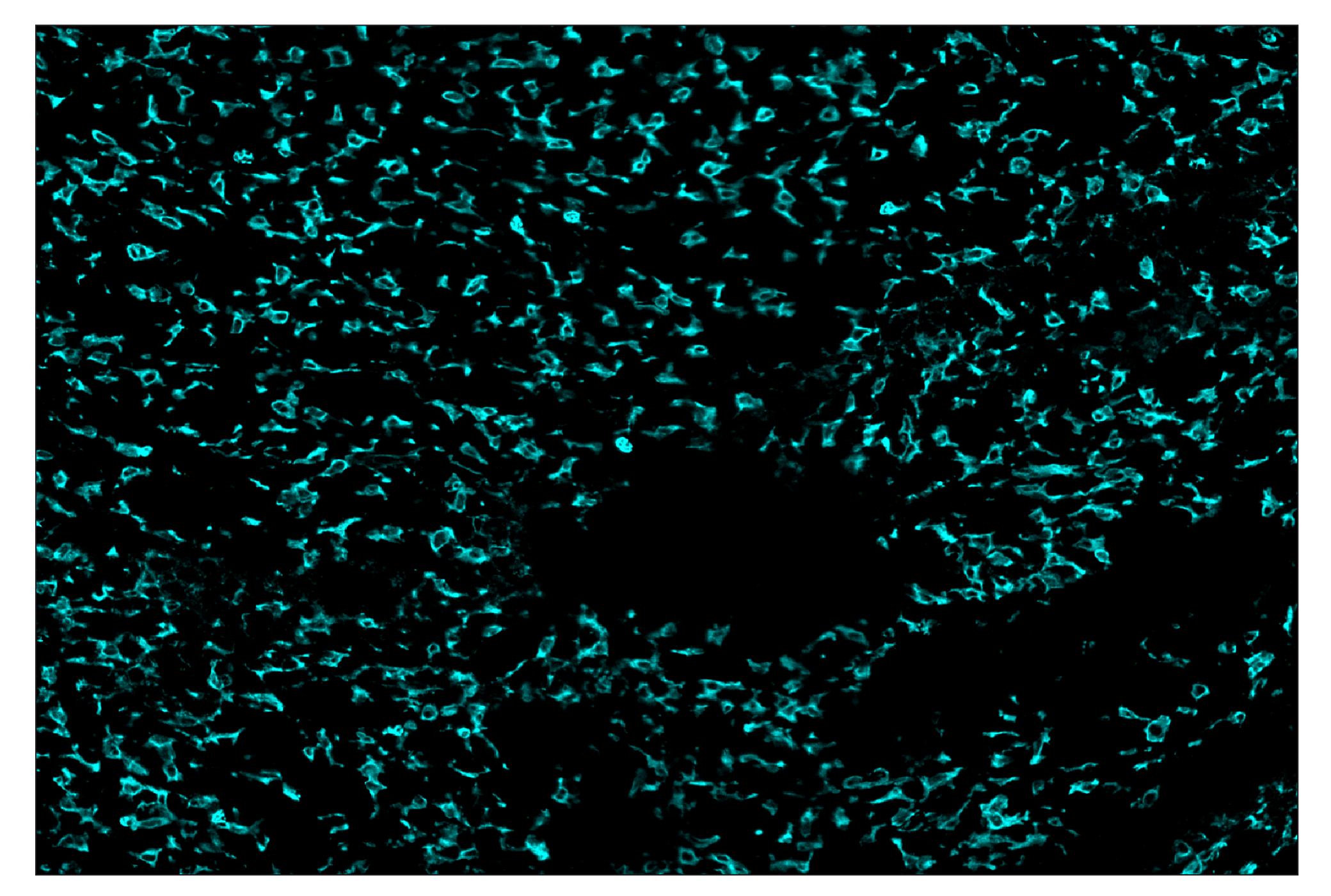 Immunohistochemistry Image 5: CD11b/ITGAM (E4K8C) & CO-0083-594 SignalStar™ Oligo-Antibody Pair