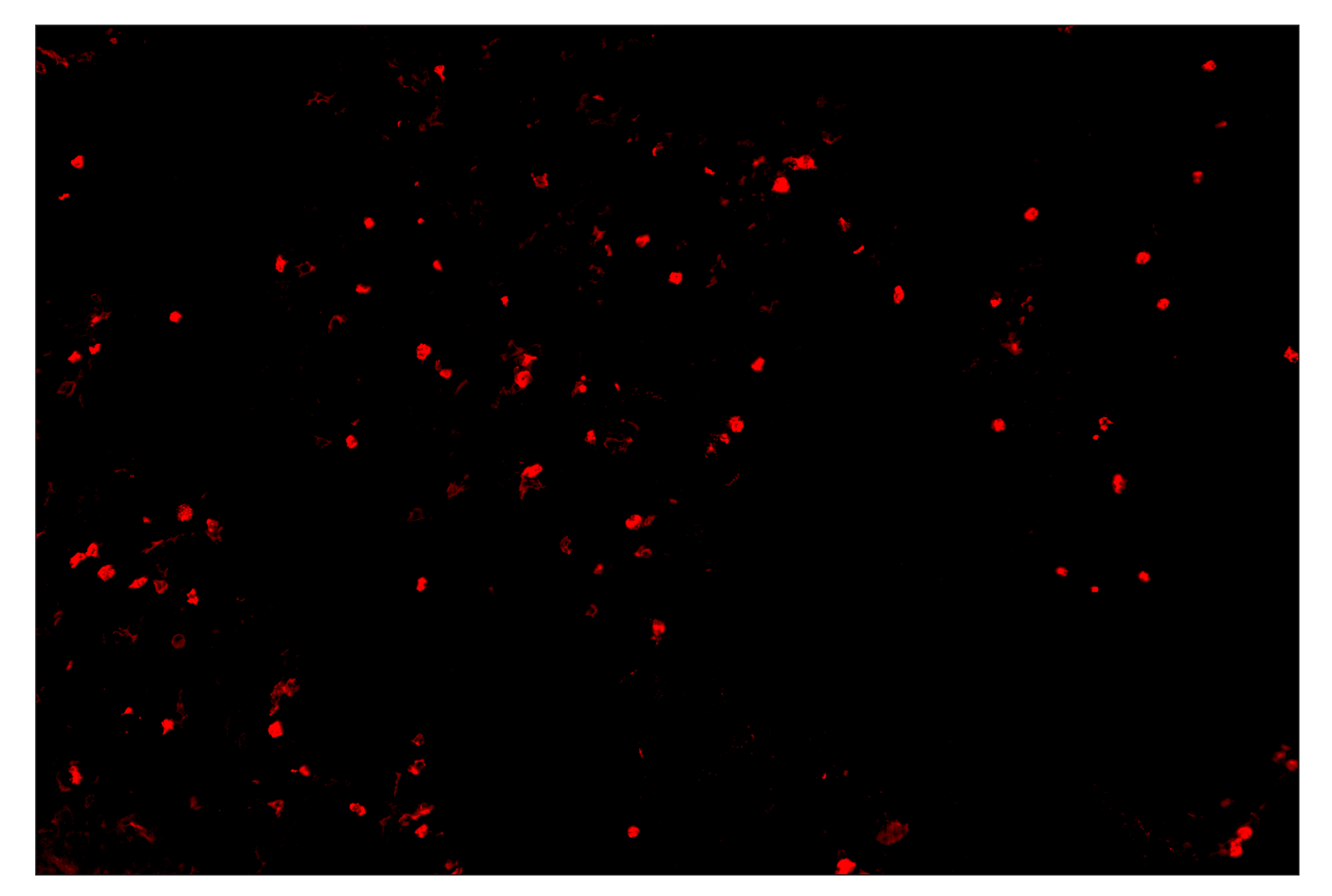 Immunohistochemistry Image 4: CD11b/ITGAM (E4K8C) & CO-0083-594 SignalStar™ Oligo-Antibody Pair