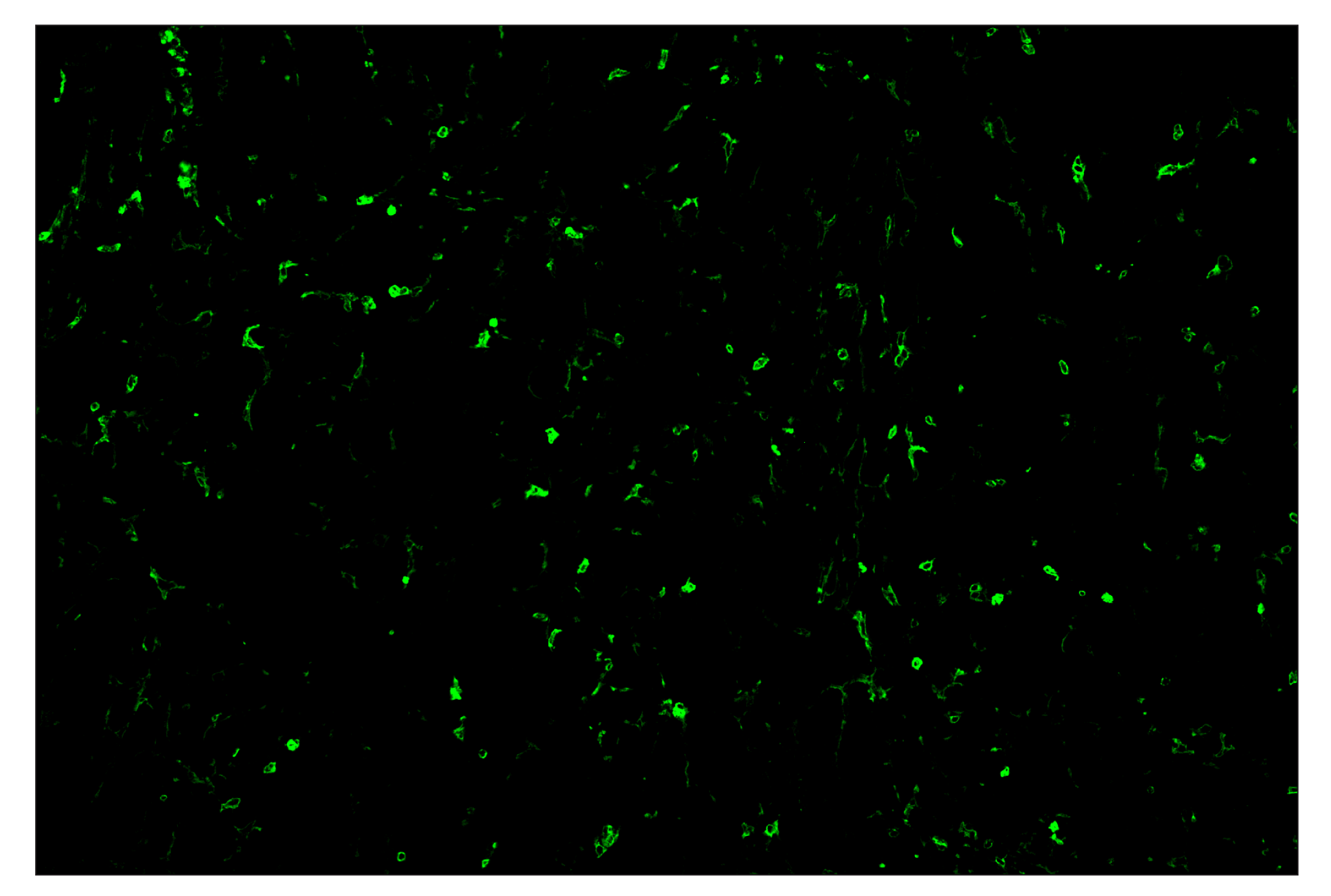 Immunohistochemistry Image 2: CD11b/ITGAM (E4K8C) & CO-0083-647 SignalStar™ Oligo-Antibody Pair