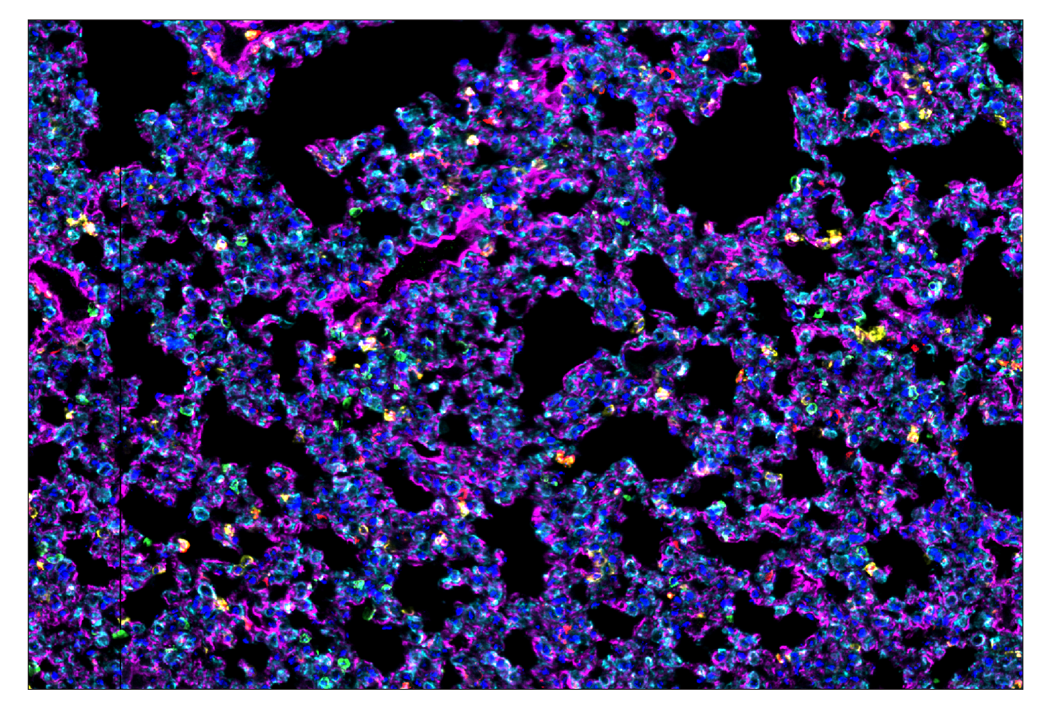 Immunohistochemistry Image 1: CD11b/ITGAM (E4K8C) & CO-0083-750 SignalStar™ Oligo-Antibody Pair