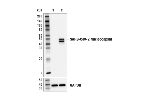 Western Blotting Image 1: SARS-CoV-2 Nucleocapsid Protein (E9L7H) XP® Rabbit mAb