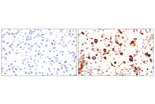 Immunohistochemistry Image 5: SARS-CoV-2 Nucleocapsid Protein (E9L7H) XP® Rabbit mAb