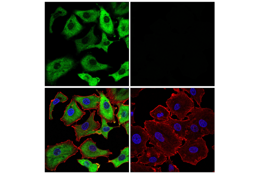 Immunofluorescence Image 1: SARS-CoV-2 Nucleocapsid Protein (E9L7H) XP® Rabbit mAb