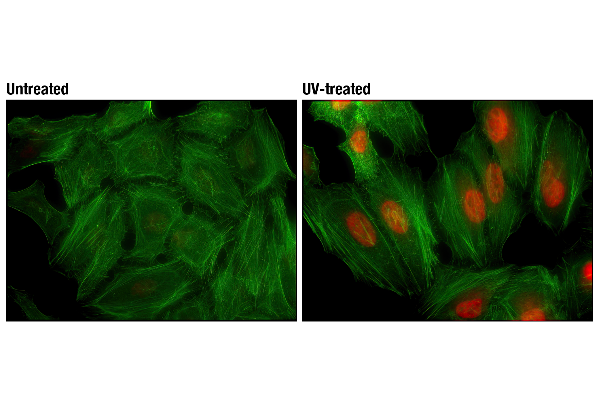 Immunofluorescence Image 1: Phospho-p38 MAPK (Thr180/Tyr182) (D3F9) XP® Rabbit mAb (Alexa Fluor® 594 Conjugate)