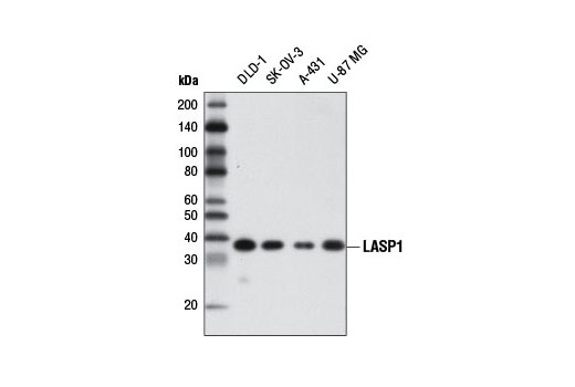 Western Blotting Image 1: LASP1 Antibody