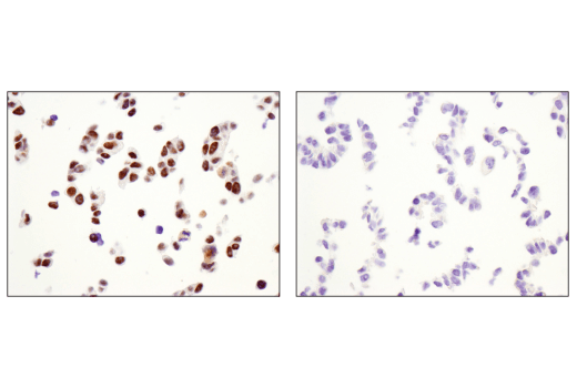  Image 64: Hypoxia Activation IHC Antibody Sampler Kit