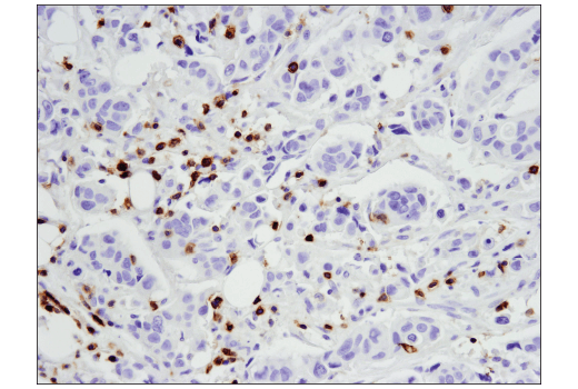 Immunohistochemistry Image 4: CD5 (E8X3S) XP® Rabbit mAb (BSA and Azide Free)