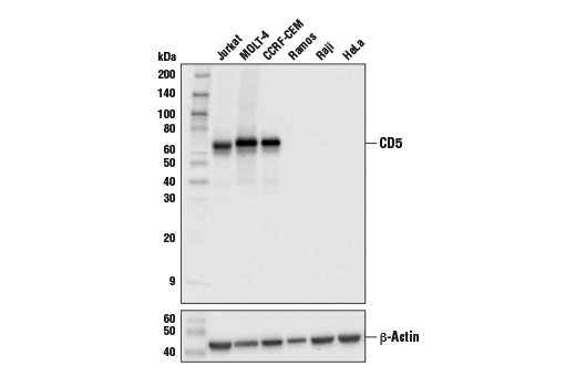 Western Blotting Image 1: CD5 (E8X3S) XP® Rabbit mAb (BSA and Azide Free)