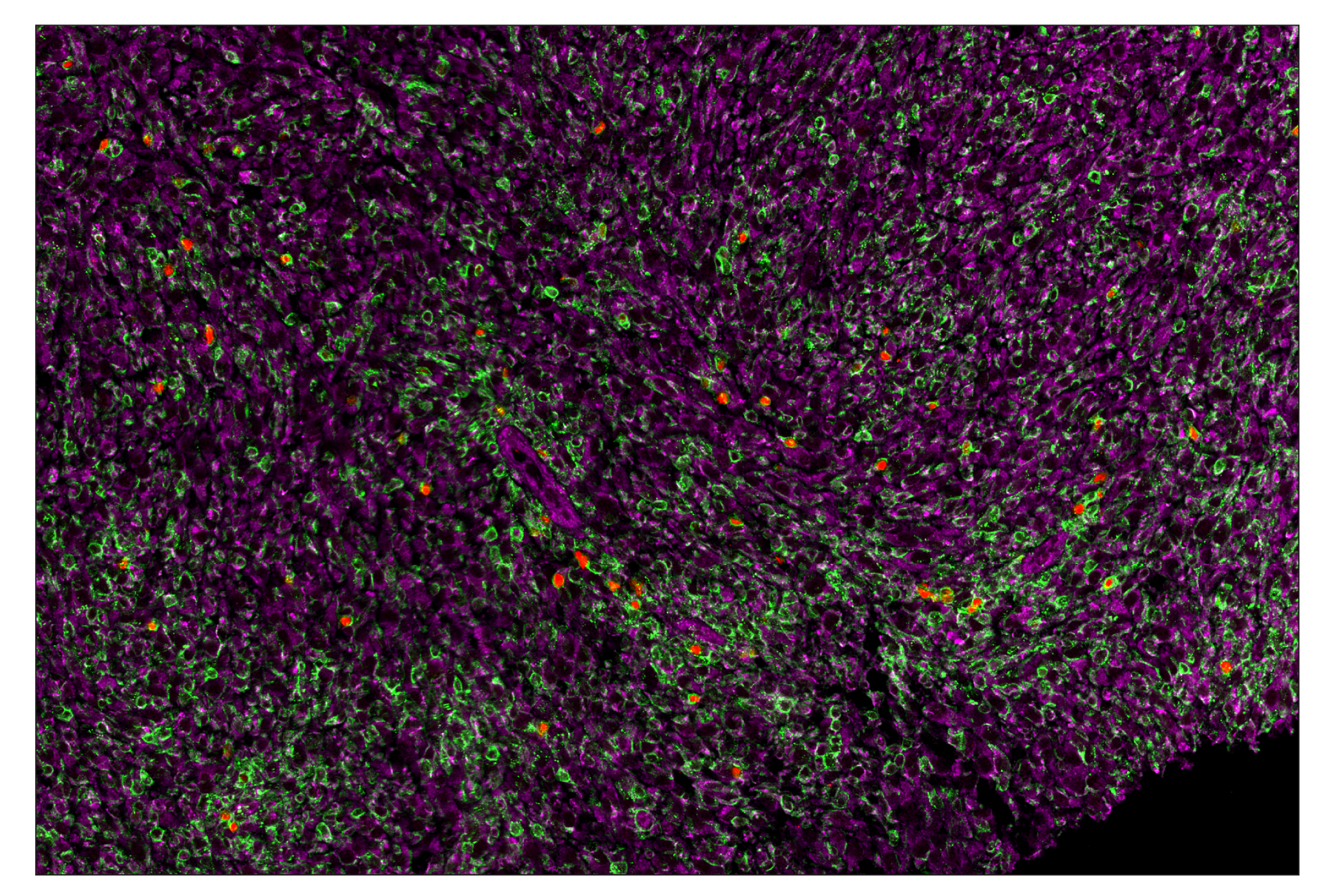 Immunohistochemistry Image 7: FoxP3 (D6O8R) & CO-0041-594 SignalStar™ Oligo-Antibody Pair