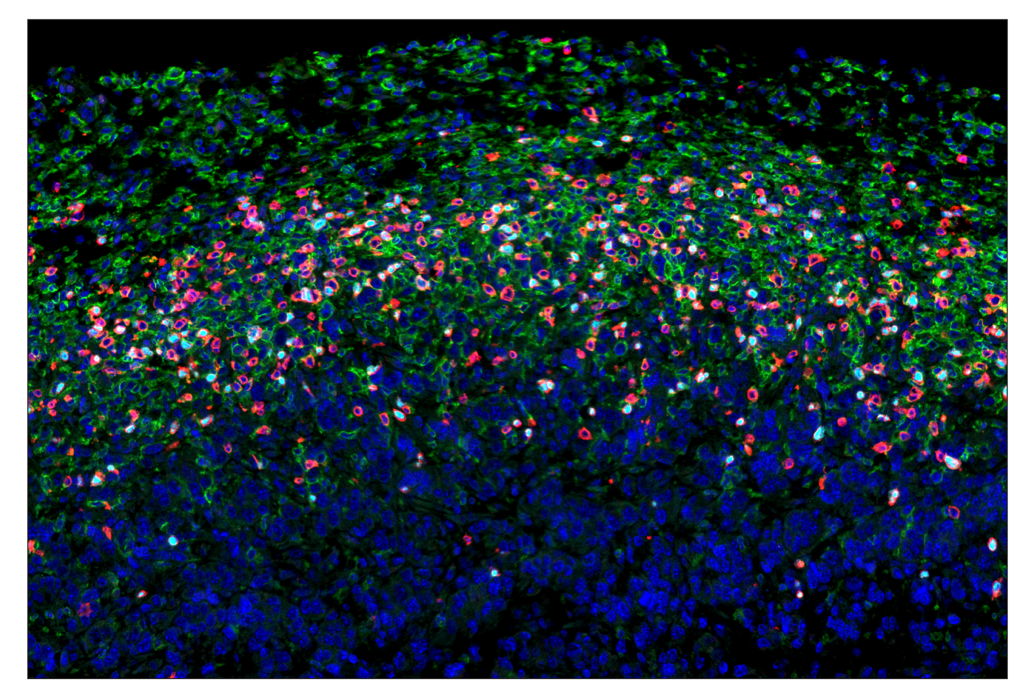 Immunohistochemistry Image 8: FoxP3 (D6O8R) & CO-0041-647 SignalStar™ Oligo-Antibody Pair