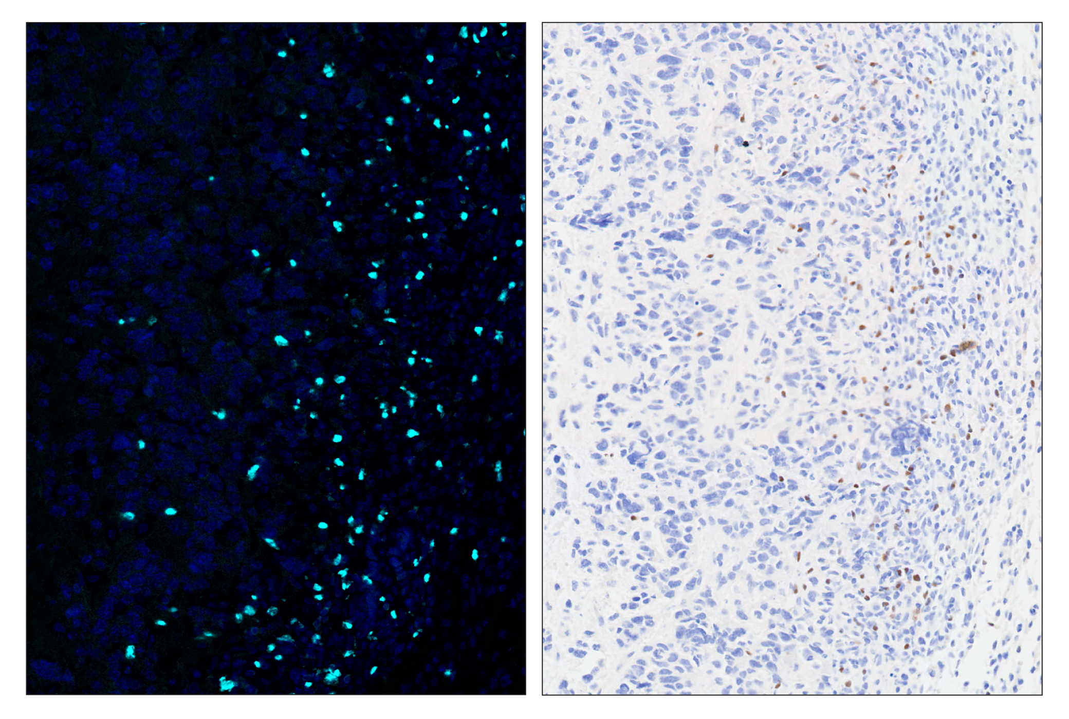 Immunohistochemistry Image 6: FoxP3 (D6O8R) & CO-0041-488 SignalStar™ Oligo-Antibody Pair