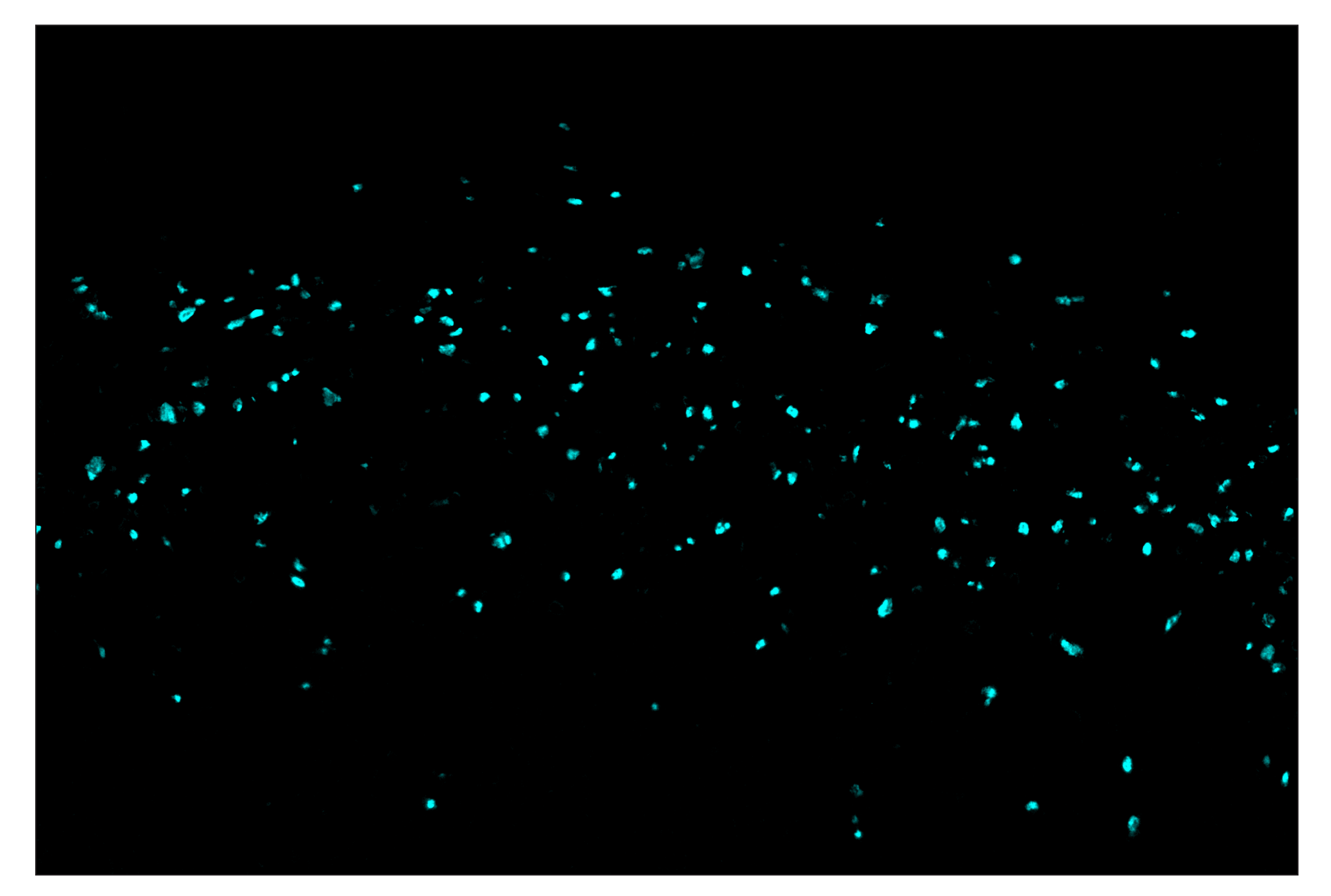 Immunohistochemistry Image 5: FoxP3 (D6O8R) & CO-0041-488 SignalStar™ Oligo-Antibody Pair