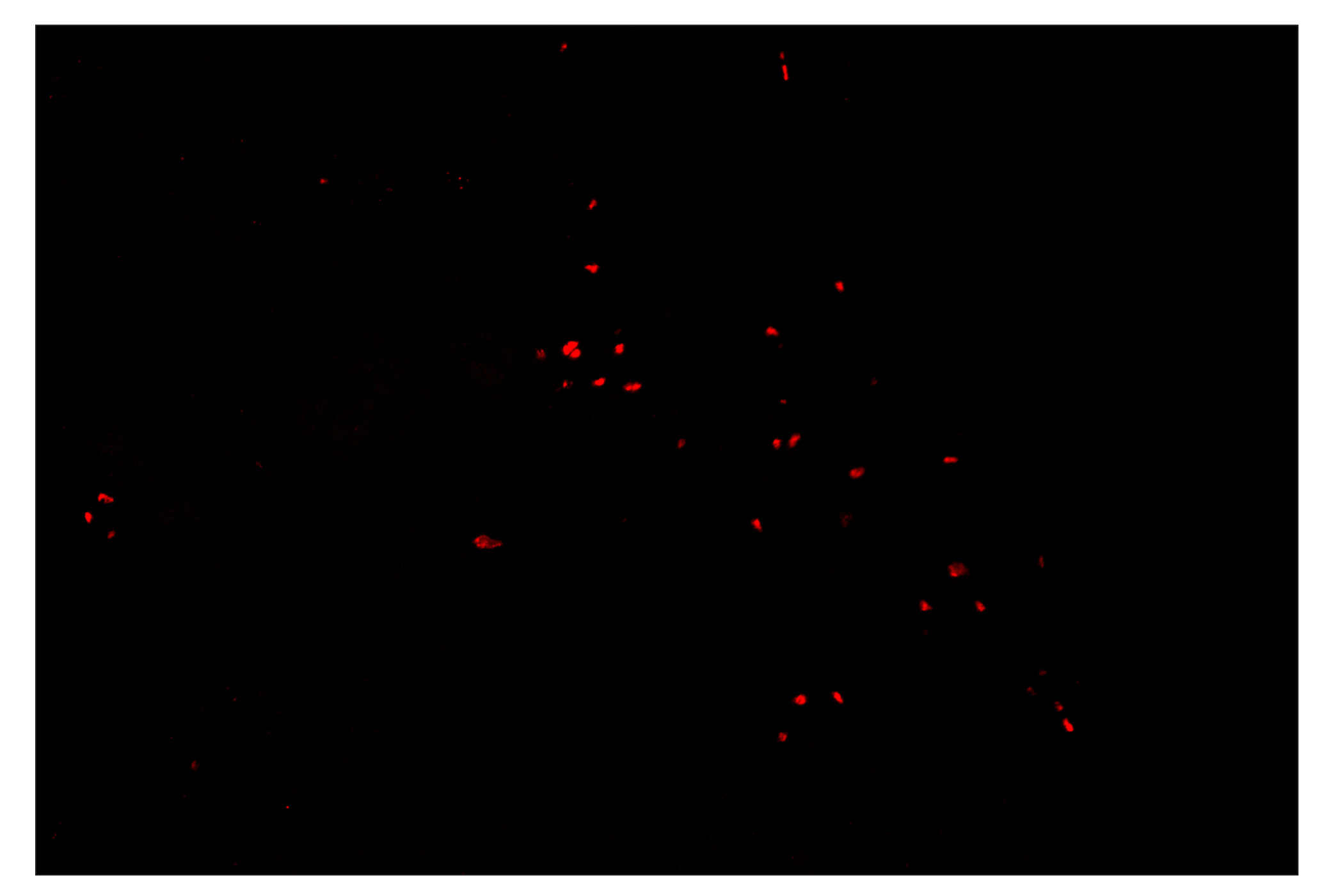 Immunohistochemistry Image 4: FoxP3 (D6O8R) & CO-0041-488 SignalStar™ Oligo-Antibody Pair