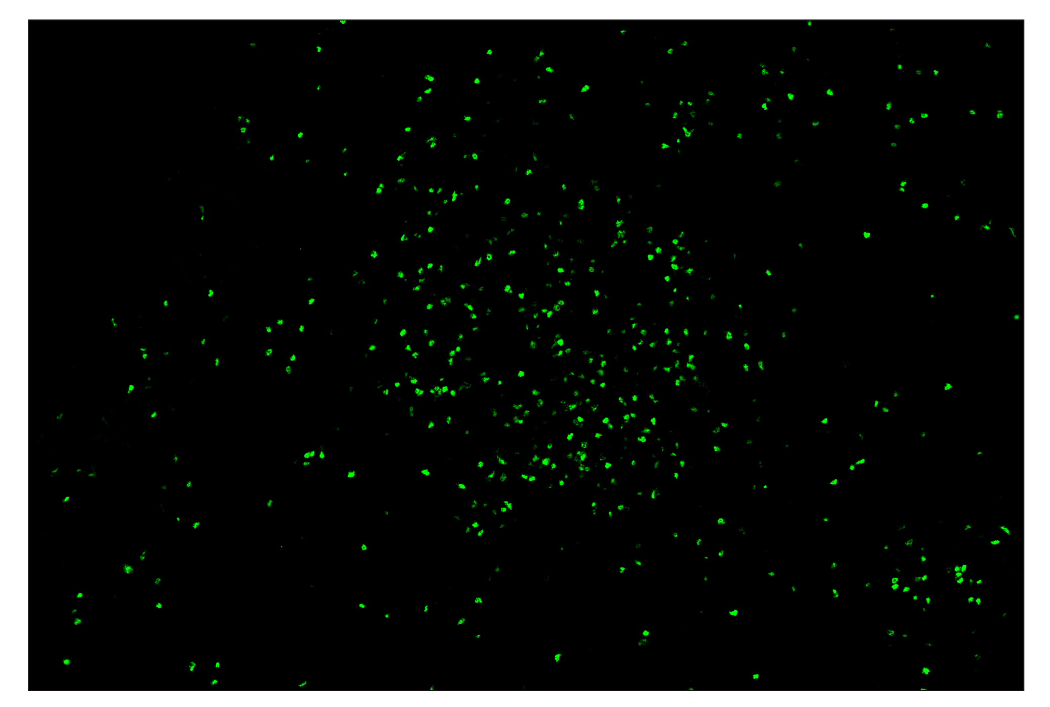 Immunohistochemistry Image 2: FoxP3 (D6O8R) & CO-0041-647 SignalStar™ Oligo-Antibody Pair