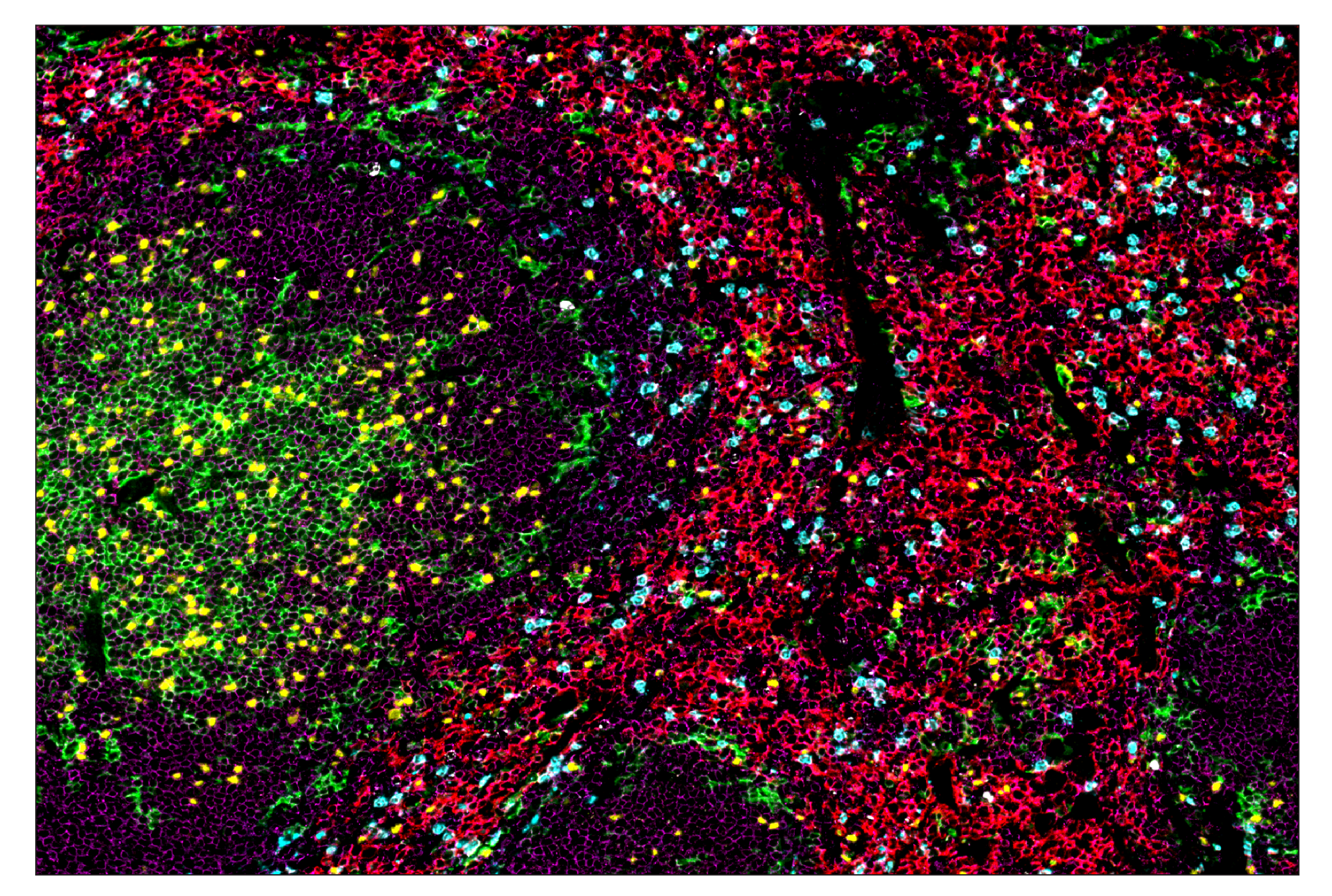 Immunohistochemistry Image 1: FoxP3 (D6O8R) & CO-0041-488 SignalStar™ Oligo-Antibody Pair