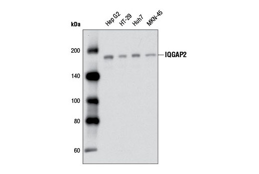 Western Blotting Image 1: IQGAP2 Antibody