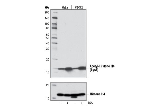 Western Blotting Image 2: Acetyl-Histone H4 (Lys5) (D12B3) Rabbit mAb