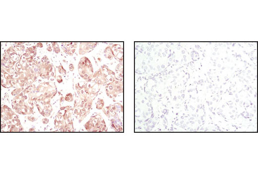 Immunohistochemistry Image 1: Akt (pan) (11E7) Rabbit mAb (BSA and Azide Free)