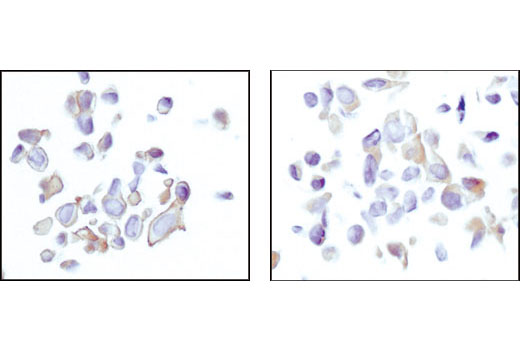 Immunohistochemistry Image 4: Akt (pan) (11E7) Rabbit mAb (BSA and Azide Free)