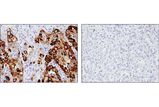 Immunohistochemistry Image 2: AGR2 (D9V2F) XP® Rabbit mAb (BSA and Azide Free)
