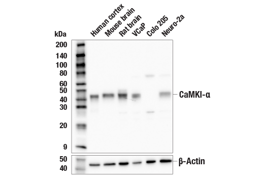 Western Blotting Image 1: CaMKI-α Antibody