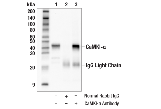 Immunoprecipitation Image 1: CaMKI-α Antibody
