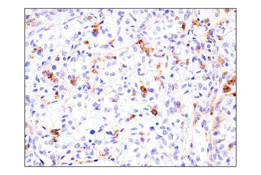 Immunohistochemistry Image 4: Axl (C89E7) Rabbit mAb (BSA and Azide Free)