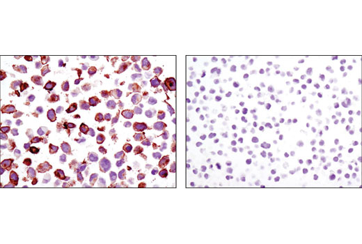  Image 34: YAP/TAZ Transcriptional Targets Antibody Sampler Kit
