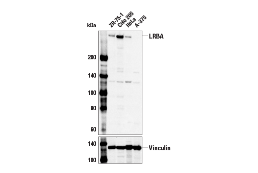 Western Blotting Image 1: LRBA Antibody