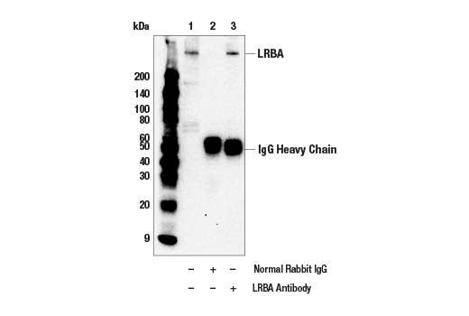 Immunoprecipitation Image 1: LRBA Antibody