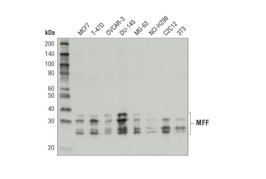 Western Blotting Image 1: MFF Antibody