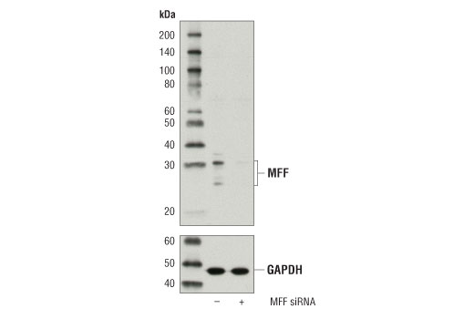 Western Blotting Image 2: MFF Antibody