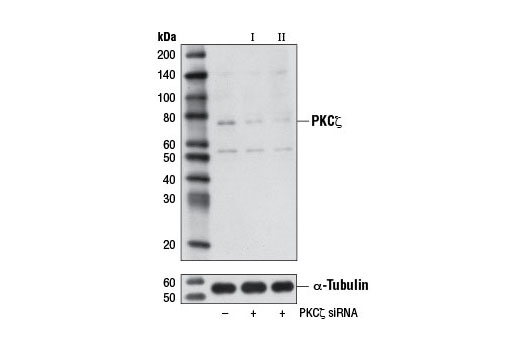  Image 1: SignalSilence® PKCζ siRNA I