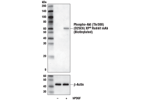 Western Blotting Image 1: Phospho-Akt (Thr308) (D25E6) XP® Rabbit mAb (Biotinylated)