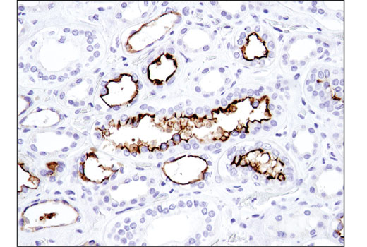 Immunohistochemistry Image 4: CD133 (D4W4N) XP® Rabbit mAb